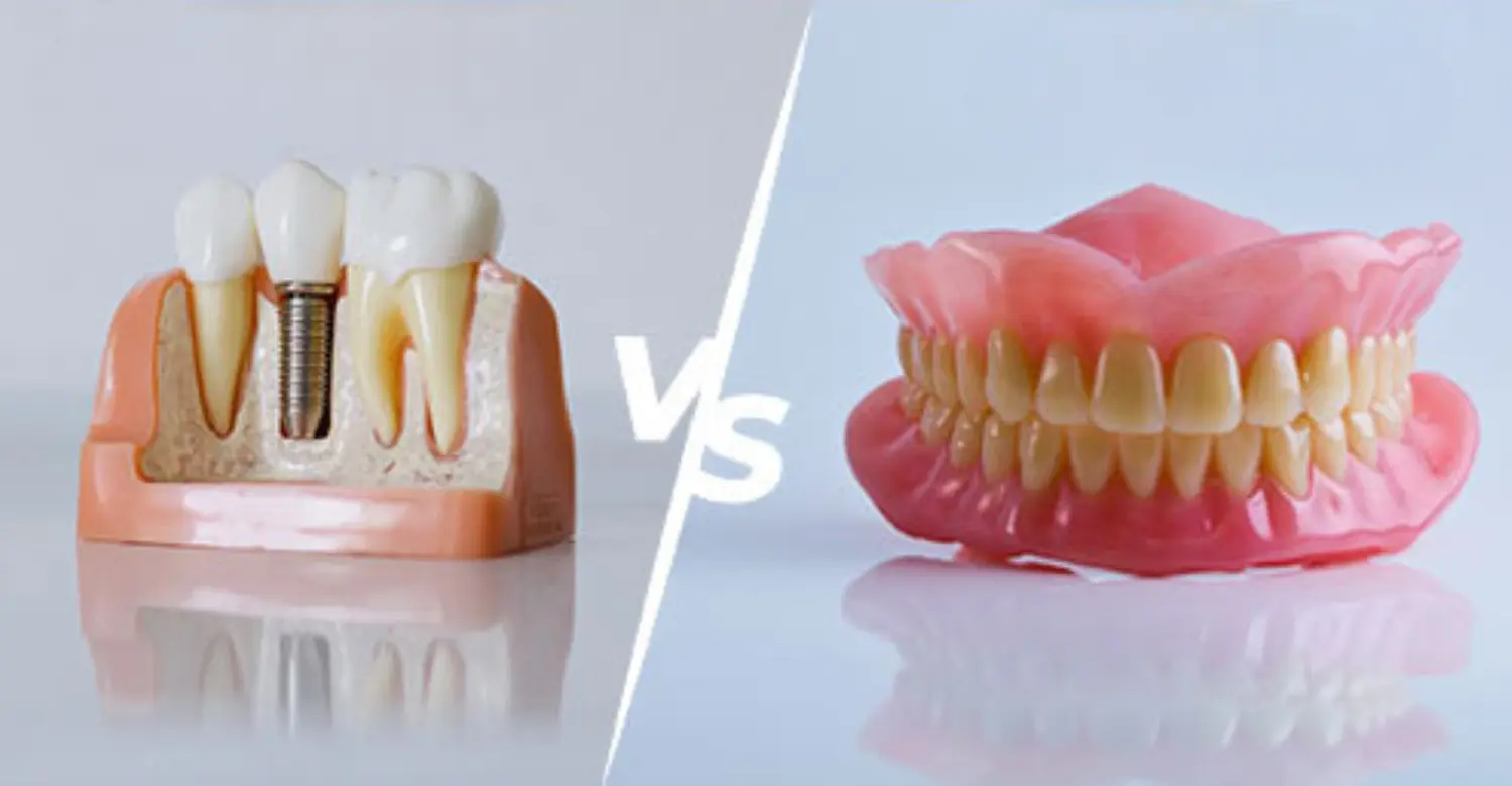 How much are dental implants vs dentures 2